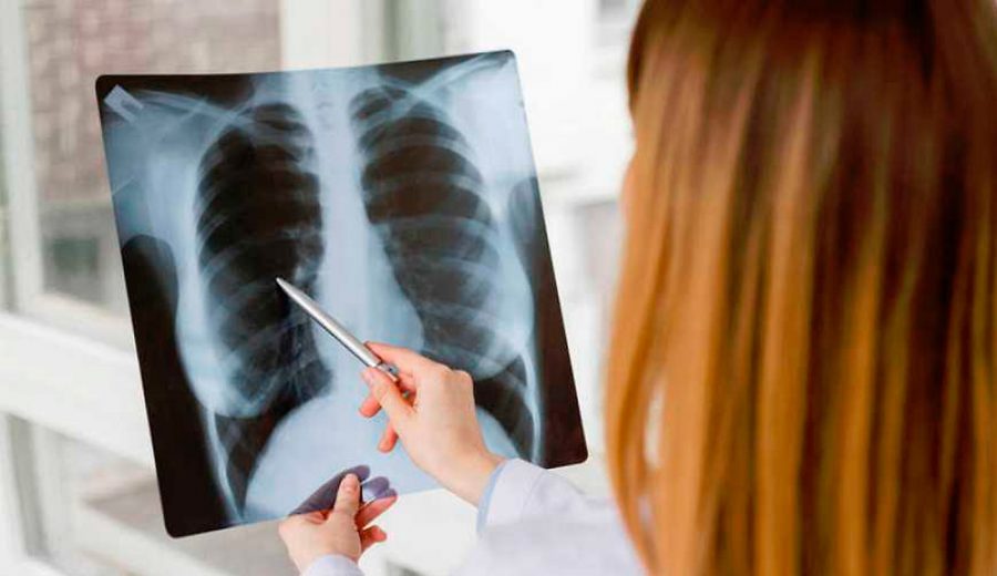 pericardium-article-smoke2-4